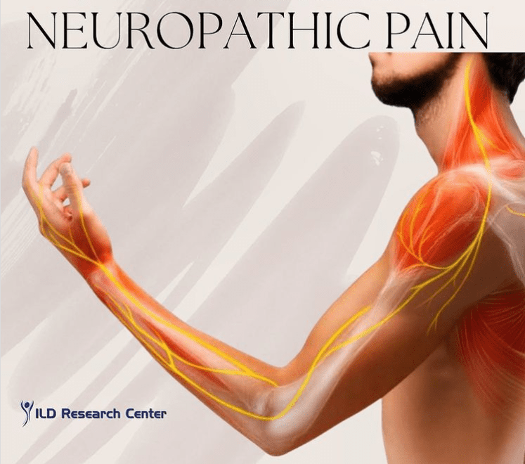 Neuropathic pain